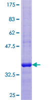 GALNT1 Protein - 12.5% SDS-PAGE of human GALNT1 stained with Coomassie Blue