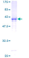 GALNT12 Protein - 12.5% SDS-PAGE of human GALNT12 stained with Coomassie Blue