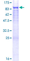 GALNT13 Protein - 12.5% SDS-PAGE of human GALNT13 stained with Coomassie Blue