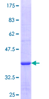 GALNT13 Protein - 12.5% SDS-PAGE Stained with Coomassie Blue.