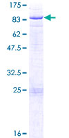 GALNT14 Protein - 12.5% SDS-PAGE of human GALNT14 stained with Coomassie Blue
