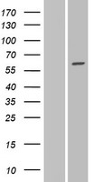 GALNT16 / GALNTL1 Protein - Western validation with an anti-DDK antibody * L: Control HEK293 lysate R: Over-expression lysate