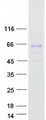 GALNT2 Protein - Purified recombinant protein GALNT2 was analyzed by SDS-PAGE gel and Coomassie Blue Staining