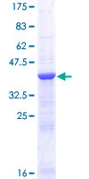 GALNT3 Protein - 12.5% SDS-PAGE of human GALNT3 stained with Coomassie Blue