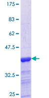 GALNT3 Protein - 12.5% SDS-PAGE Stained with Coomassie Blue.