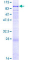 GALNT6 Protein - 12.5% SDS-PAGE of human GALNT6 stained with Coomassie Blue