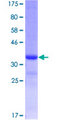 GALNT6 Protein - 12.5% SDS-PAGE Stained with Coomassie Blue.