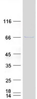 GALNT6 Protein - Purified recombinant protein GALNT6 was analyzed by SDS-PAGE gel and Coomassie Blue Staining