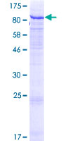 GALNT7 Protein - 12.5% SDS-PAGE of human GALNT7 stained with Coomassie Blue