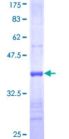 GALNT7 Protein - 12.5% SDS-PAGE Stained with Coomassie Blue.