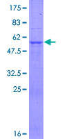 GALNT9 Protein - 12.5% SDS-PAGE of human GALNT9 stained with Coomassie Blue