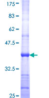 GALNT9 Protein - 12.5% SDS-PAGE Stained with Coomassie Blue.