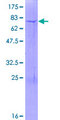 GALNTL5 Protein - 12.5% SDS-PAGE of human GALNTL5 stained with Coomassie Blue