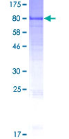 GALNTL6 Protein - 12.5% SDS-PAGE of human GALNT17 stained with Coomassie Blue