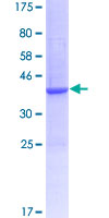 GALP / Alarin Protein - 12.5% SDS-PAGE of human GALP stained with Coomassie Blue