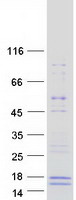 GALP / Alarin Protein - Purified recombinant protein GALP was analyzed by SDS-PAGE gel and Coomassie Blue Staining