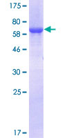 GALT Protein - 12.5% SDS-PAGE of human GALT stained with Coomassie Blue