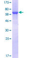 GALT Protein - 12.5% SDS-PAGE of human GALT stained with Coomassie Blue