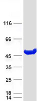GALT Protein - Purified recombinant protein GALT was analyzed by SDS-PAGE gel and Coomassie Blue Staining