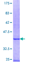 GALT4 / B3GALT4 Protein - 12.5% SDS-PAGE Stained with Coomassie Blue.
