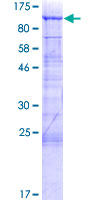 Gametogenetin / GGN Protein - 12.5% SDS-PAGE of human GGN stained with Coomassie Blue