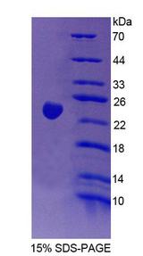 GAMT Protein - Recombinant  Guanidinoacetate-N-Methyltransferase By SDS-PAGE
