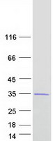 GAMT Protein - Purified recombinant protein GAMT was analyzed by SDS-PAGE gel and Coomassie Blue Staining