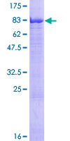 GAN Protein - 12.5% SDS-PAGE of human GAN stained with Coomassie Blue