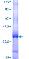 GAN Protein - 12.5% SDS-PAGE Stained with Coomassie Blue.