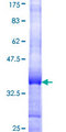 GAN Protein - 12.5% SDS-PAGE Stained with Coomassie Blue.