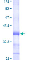 GANAB / Alpha Glucosidase II Protein - 12.5% SDS-PAGE Stained with Coomassie Blue.