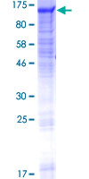 GANC Protein - 12.5% SDS-PAGE of human GANC stained with Coomassie Blue