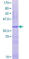 GANC Protein - 12.5% SDS-PAGE Stained with Coomassie Blue.