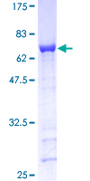 GAP43 Protein - 12.5% SDS-PAGE of human GAP43 stained with Coomassie Blue