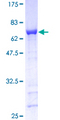GAP43 Protein - 12.5% SDS-PAGE of human GAP43 stained with Coomassie Blue