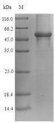 GAPDH Protein - (Tris-Glycine gel) Discontinuous SDS-PAGE (reduced) with 5% enrichment gel and 15% separation gel.