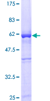 GAPDH Protein - 12.5% SDS-PAGE of human GAPDH stained with Coomassie Blue
