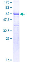 GAPDH Protein - 12.5% SDS-PAGE of human GAPDH stained with Coomassie Blue