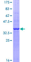 GAPDH Protein - 12.5% SDS-PAGE Stained with Coomassie Blue.