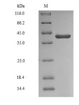 GAPDHS / GAPDS Protein - (Tris-Glycine gel) Discontinuous SDS-PAGE (reduced) with 5% enrichment gel and 15% separation gel.