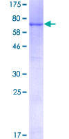 GAPDHS / GAPDS Protein - 12.5% SDS-PAGE of human GAPDS stained with Coomassie Blue