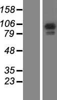 GAPIII / RASA3 Protein - Western validation with an anti-DDK antibody * L: Control HEK293 lysate R: Over-expression lysate