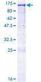 GAPIII / RASA3 Protein - 12.5% SDS-PAGE of human RASA3 stained with Coomassie Blue