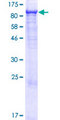 GAPVD1 Protein - 12.5% SDS-PAGE of human GAPVD1 stained with Coomassie Blue