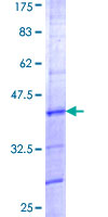 GAR1 / NOLA1 Protein - 12.5% SDS-PAGE Stained with Coomassie Blue.