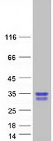 GAR1 / NOLA1 Protein - Purified recombinant protein GAR1 was analyzed by SDS-PAGE gel and Coomassie Blue Staining