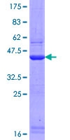 GARNL1 / RALGAPA1 Protein - 12.5% SDS-PAGE Stained with Coomassie Blue.