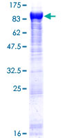 GARS / Glycyl tRNA Synthetase Protein - 12.5% SDS-PAGE of human GARS stained with Coomassie Blue