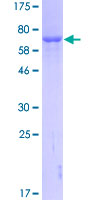 GART / GARS Protein - 12.5% SDS-PAGE of human GART stained with Coomassie Blue