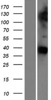 GAS1 Protein - Western validation with an anti-DDK antibody * L: Control HEK293 lysate R: Over-expression lysate